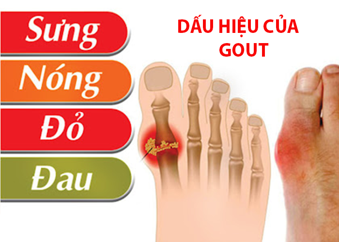 anh chi tiet uw2